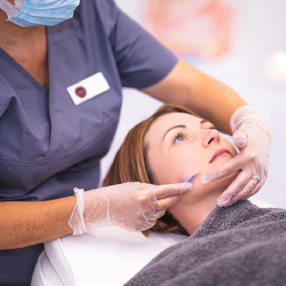 Dermaplaning Facial Blackburn